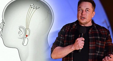 Elon Musk'ın şirketi Neuralink onay aldı: Beyin çipi deneyleri başlıyor