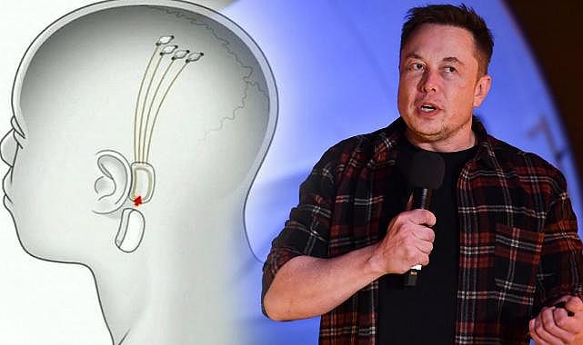 Elon Musk'ın şirketi Neuralink onay aldı: Beyin çipi deneyleri başlıyor