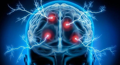 PAÜ Hastanesi'nde epilepsi hastalığına tedavi