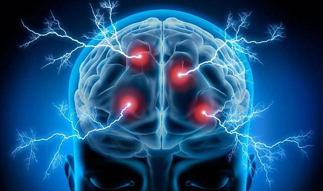 PAÜ Hastanesi'nde epilepsi hastalığına tedavi