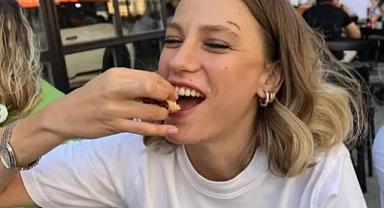 Serenay Sarıkaya hayranlarını korkuttu! ''Kaşımdaki yara...''