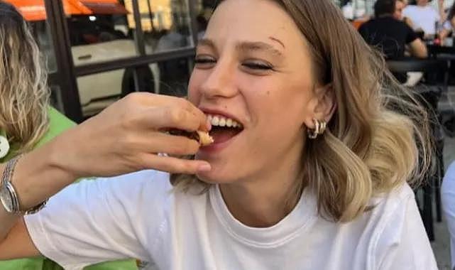 Serenay Sarıkaya hayranlarını korkuttu! ''Kaşımdaki yara...''