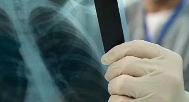 Dikkat, sinsi ilerliyor: 10 hastadan 1’i doktora başvuruyor