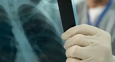 Dikkat, sinsi ilerliyor: 10 hastadan 1’i doktora başvuruyor