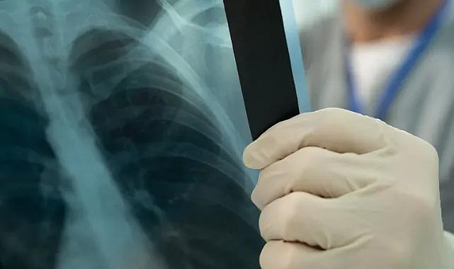 Dikkat, sinsi ilerliyor: 10 hastadan 1’i doktora başvuruyor
