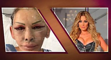 Petek Dinçöz’ün annesi Esra Süay Toğuş yüz gençleştirme ameliyatı oldu!