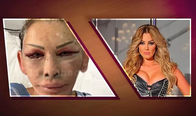 Petek Dinçöz’ün annesi Esra Süay Toğuş yüz gençleştirme ameliyatı oldu!