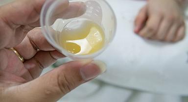 Kolostrum Sütü: Faydaları ve İçilme Durumu