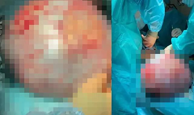 Hamile olduğunu düşünen kadın bebeğinin durumunu öğrenmek için hastaneye gitti! Gerçek çok farklı çıktı: Bebek değil tümörmüş