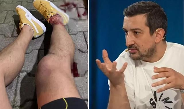 Serhat Akın Silahlı Saldırıya Uğradı