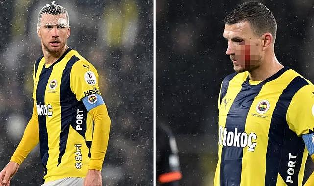Edin Dzeko'nun kafasını yaran futbolcu sessizliğini bozdu