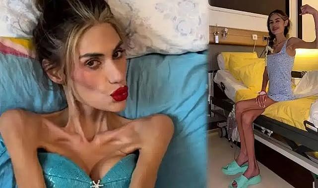23 kiloya kadar düşmüştü: Nihal Candan hayatını kaybetti