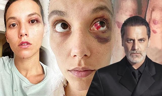 Ozan Güven'e eski sevgilisine şiddetten hapis cezası