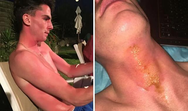 Altın kolye tatili kabusa çevirdi