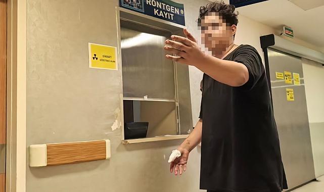 Motosiklet zincirine elini kaptıran çocuğun parmağı koptu