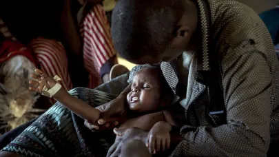 Zamfara ve Nijer’de kolera salgını: 11 ölü