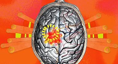 Sıcak hava nörolojik hastalıkları tetikliyor 