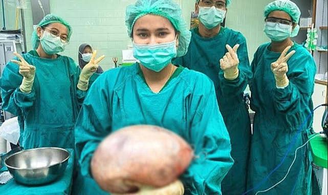 Taylandlı kadının karnından 7 kiloluk kist çıktı