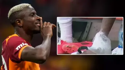 Galatasaray’dan Osimhen açıklaması: Tedavi başladı