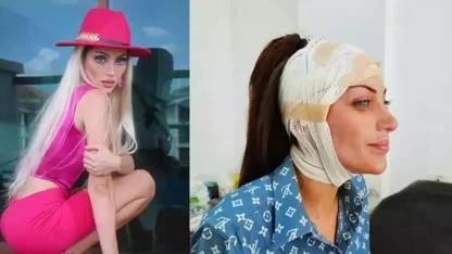 Barbie'ye benzemek için 27 kez ameliyat olmuştu: Fenomenin gizemli ölümü!