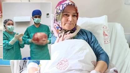 Karın ağrısıyla hastaneye gitti: 8,5 kiloluk kitle çıkarıldı!