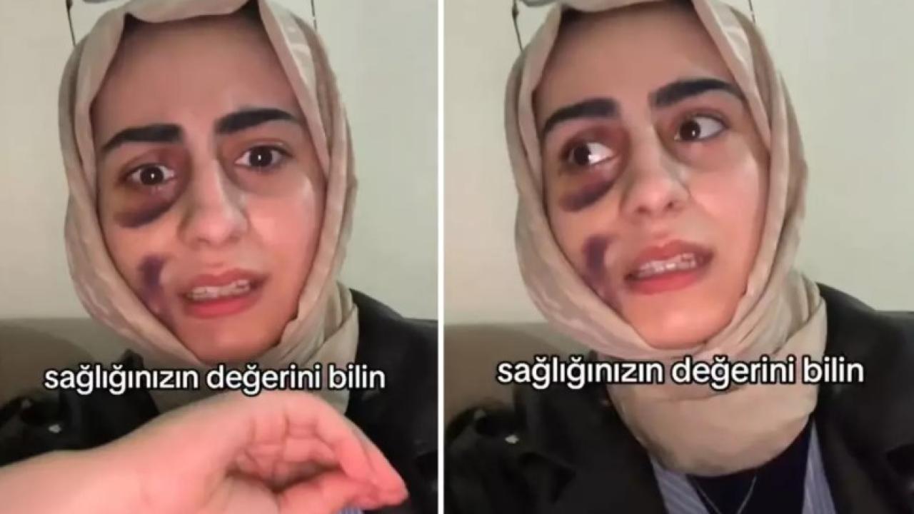 Stajyer doktora tedavi olan kadın video çekip isyan etti