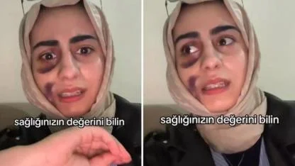 Stajyer doktora tedavi olan kadın video çekip isyan etti