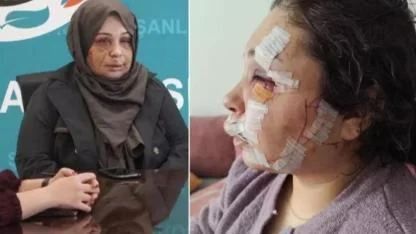 Eşini bu hale getiren Cumhurbaşkanı Koruma Dairesi personeli tutuklandı