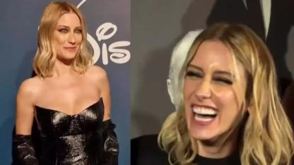 Yaptırdığı işleme tepki yağmıştı: Hazal Kaya'dan estetik açıklaması