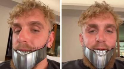 Bir maçla 92 milyon dolar kazanmıştı Çenesi kırılan Jake Paul ikinci kez ameliyat oldu