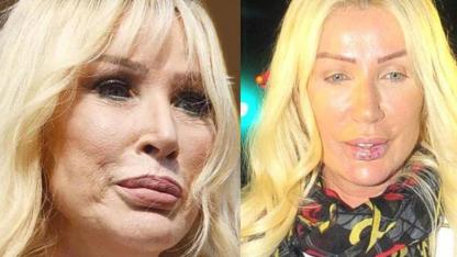 Estetikle Değişimleri Olay Oldu: İşte Görünümleriyle Gündemden Düşmeyen 10 Türk Ünlü